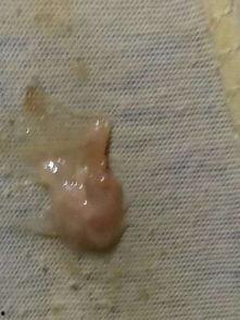 子宫肌瘤可否吃哈密瓜,哈密瓜的食用指南